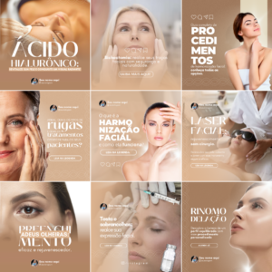 posts para harmonização facial