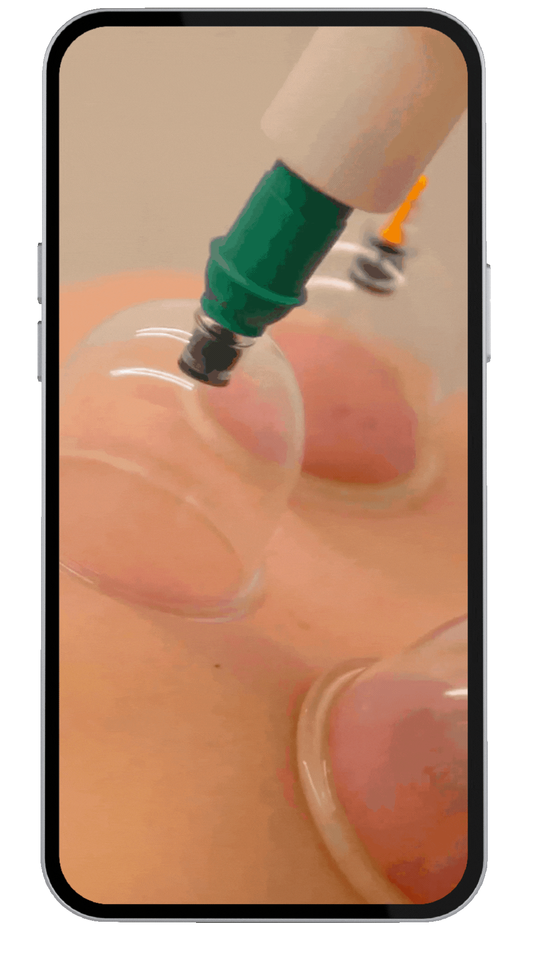 Vídeo Procedimentos